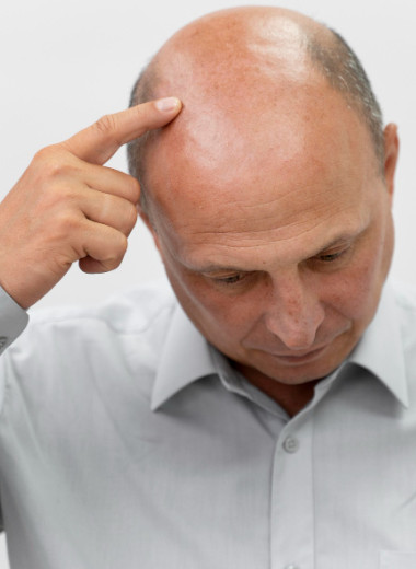 Ученые раскрыли секрет облысения и способ его остановить