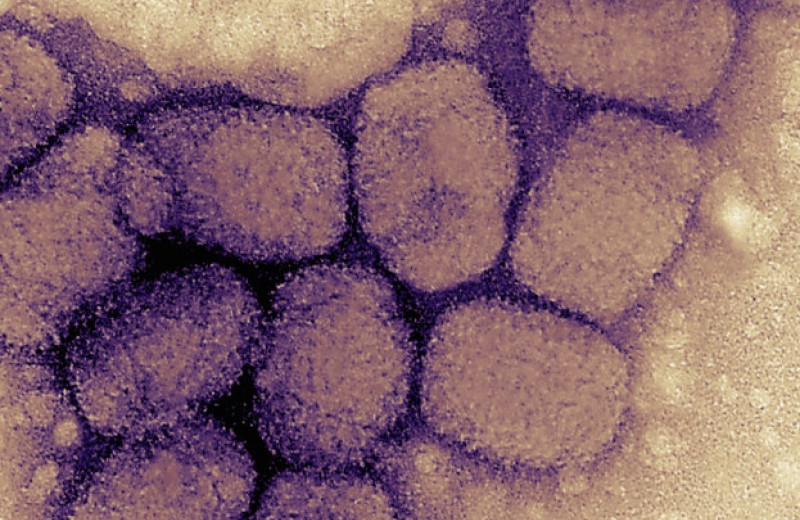 Оспа оказалась намного старше, чем считали ученые — этому вирусу не меньше трех тысяч лет