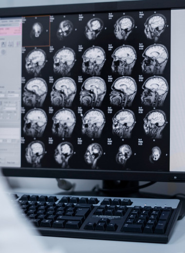 Ученые раскрыли секрет, почему у больных раком не развивается болезнь Альцгеймера — и наоборот