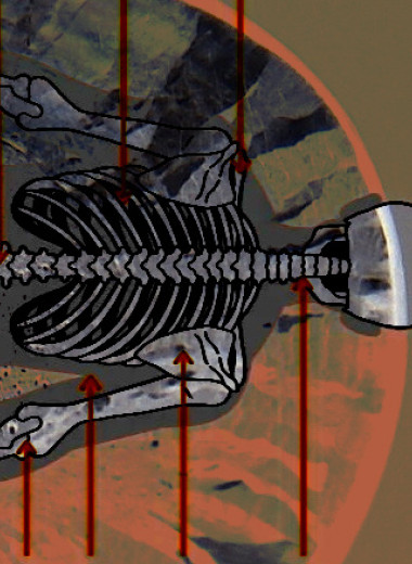 Высокий уровень свинца в костях связали с повышенной сердечно-сосудистой смертностью