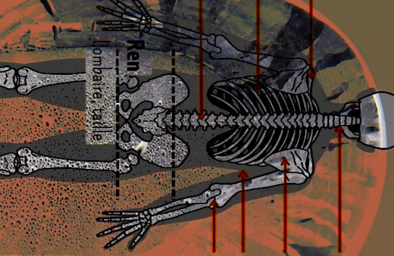 Высокий уровень свинца в костях связали с повышенной сердечно-сосудистой смертностью