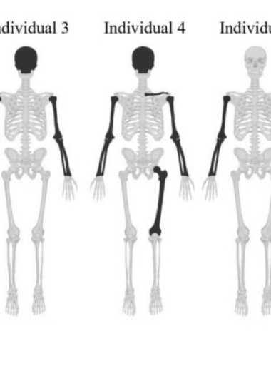 Останки из старинного колодца Ричмонда связали с учебой студентов-медиков