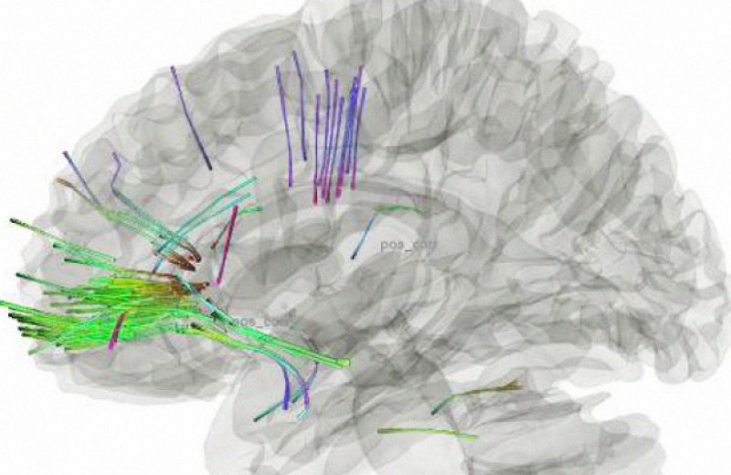 Изменение связей в мозге космонавтов объяснили нейропластичностью