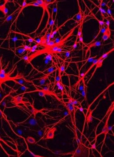 Репрограммирование клеток в мозге живой мыши сняло симптомы болезни Паркинсона