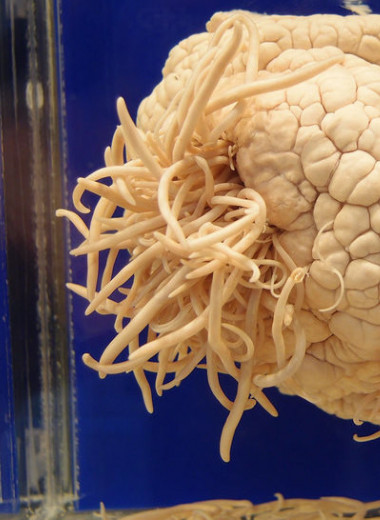 Пожиратель мозга: паразит Naegleria fowleri, питающийся серым веществом нашей черепной коробки