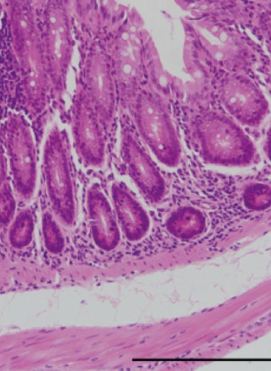 Дифференцировку моноцитов в толстой кишке у мышей связали с интерфероном 5