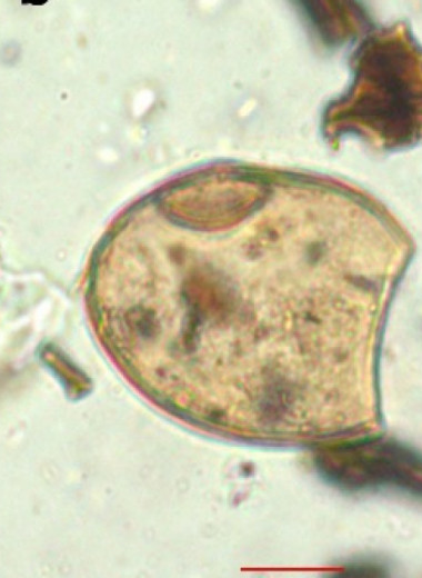 Яйца паразитов указали на плохую санитарную обстановку в средневековой Фанагории