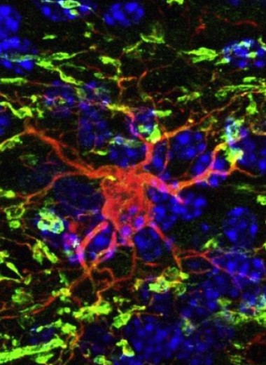 Стволовые клетки человека восстановили миелиновые оболочки в мозге взрослых мышей