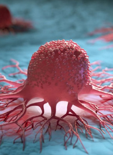 Ученые выяснили, как уничтожать раковые опухоли с помощью лазера и наночастиц кремния