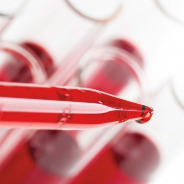 Клинический анализ крови: сколько, когда и зачем?