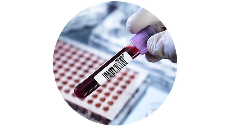 уровень кислорода в крови анализ ABG