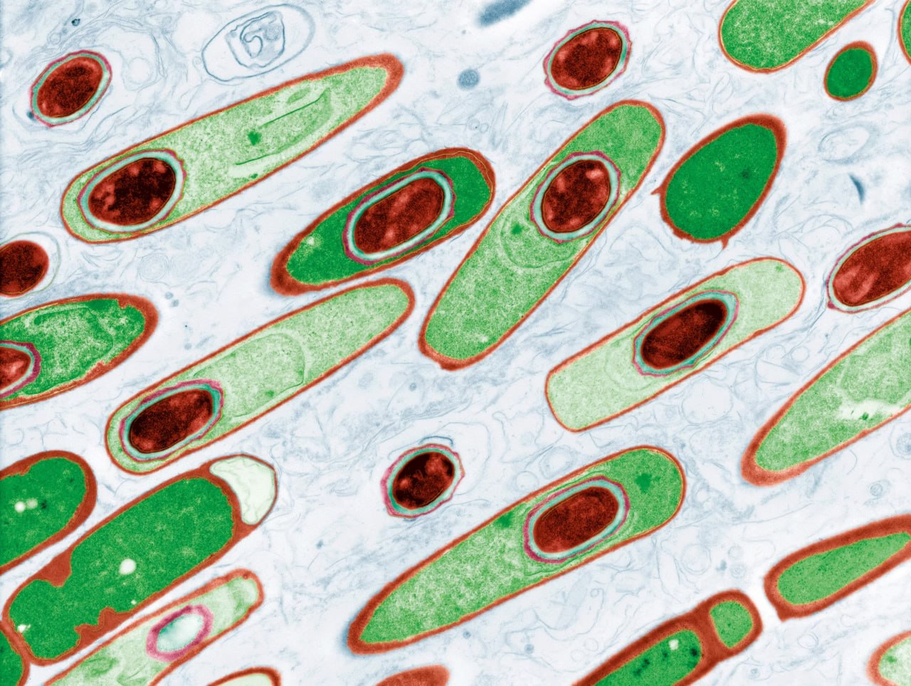 Бактерия Bacillus anthracis